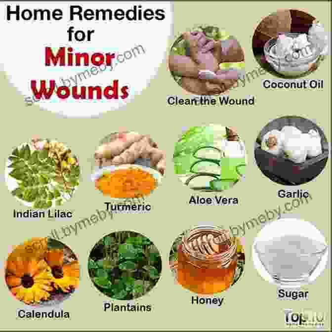 Chamomile Flowers Home Remedies To Treat Minor Wounds